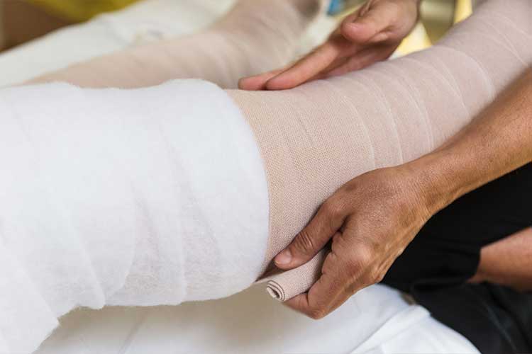 Lipedema Treatment in Montreal, Quebec — Canada