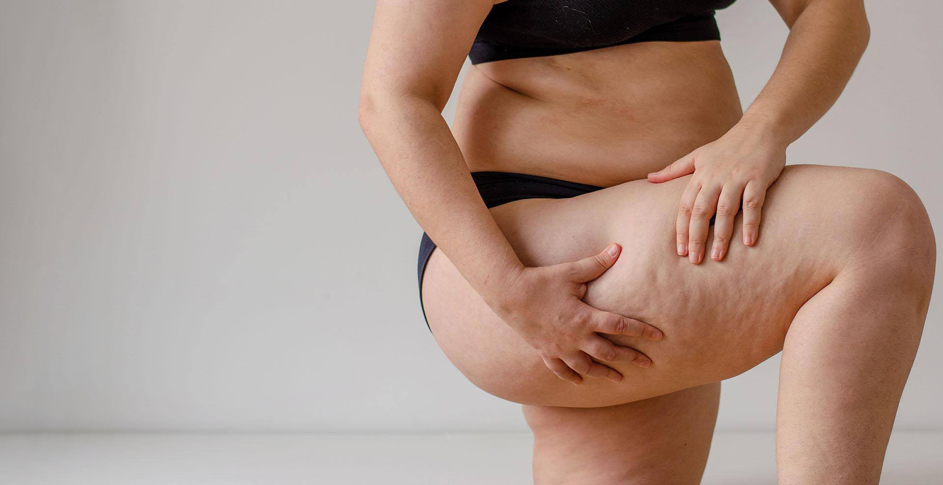 Lipedema treatment - Montreal, Laval & Westmount with Dr. Edouard